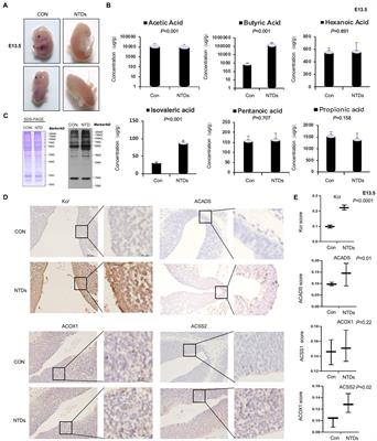 Folate-deficiency induced acyl-CoA synthetase short-chain family member 2 increases lysine crotonylome involved in neural tube defects